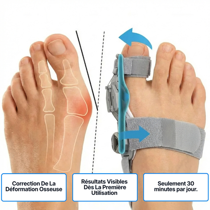 Correcteur Hallux-Valgus - Soulagement Instantané