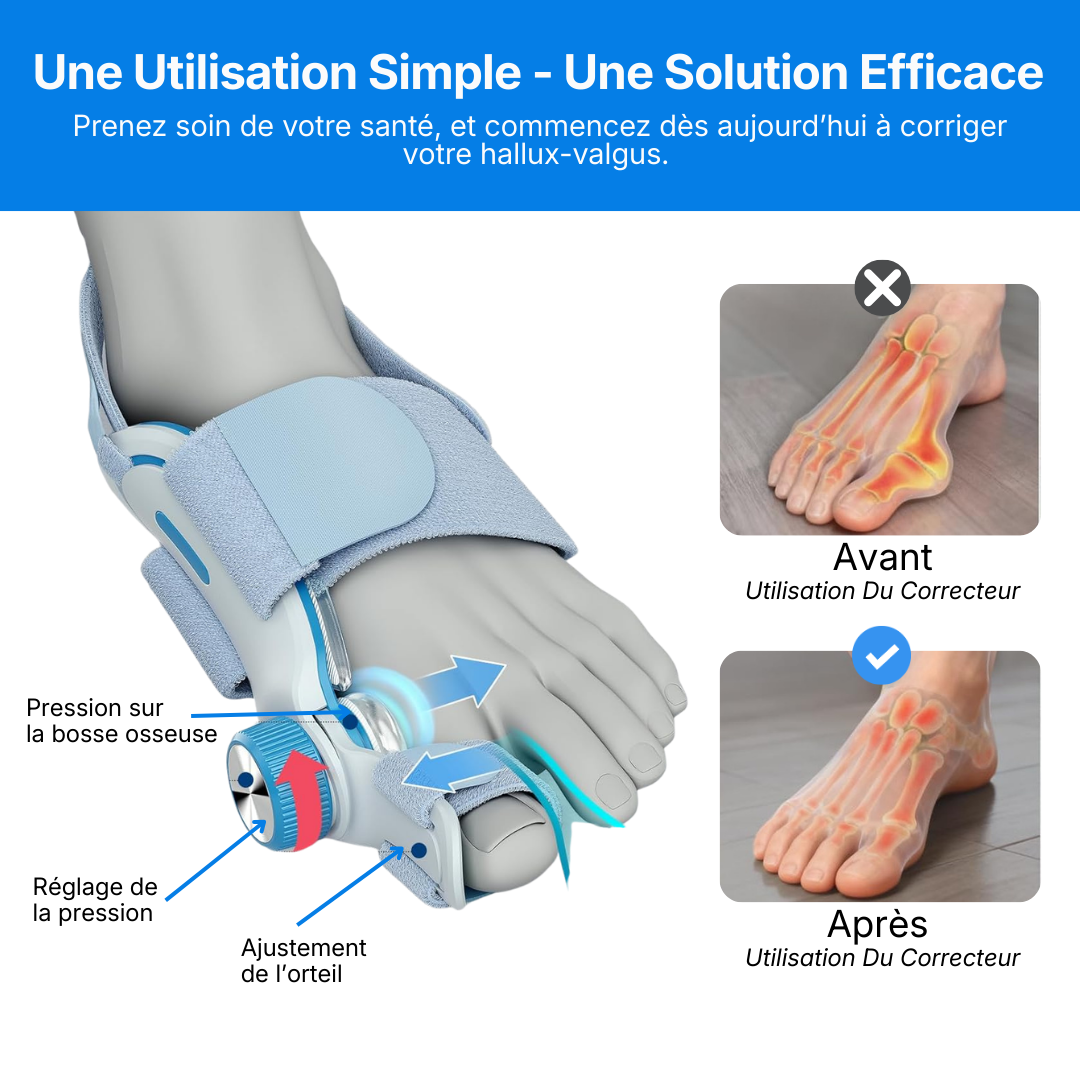 Correcteur Hallux-Valgus